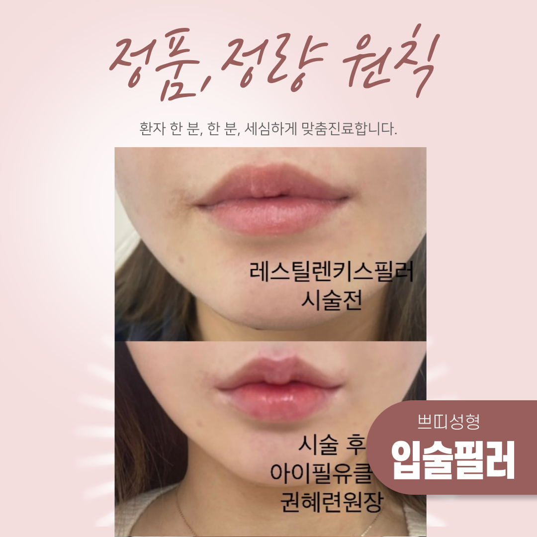 정품,정량 원칙 시술